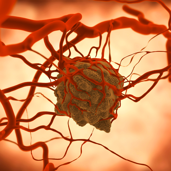 cancer treatment